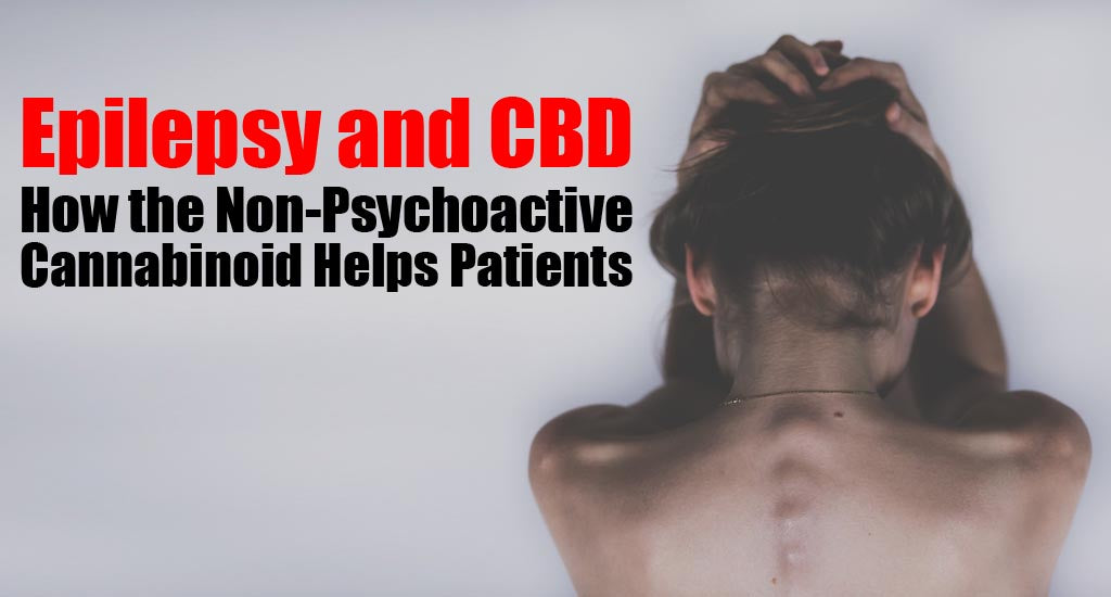 cbd-oil-dosage-for-seizures-in-adults-Epileptic-cbd-oil-can-treat-epileptic-patients